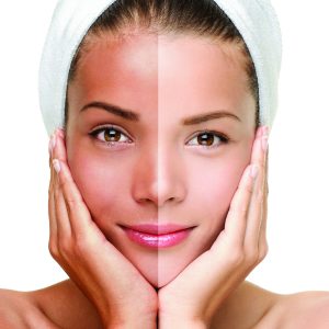 Brightening Facial