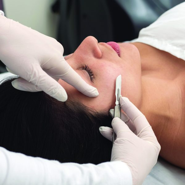 Dermaplaning